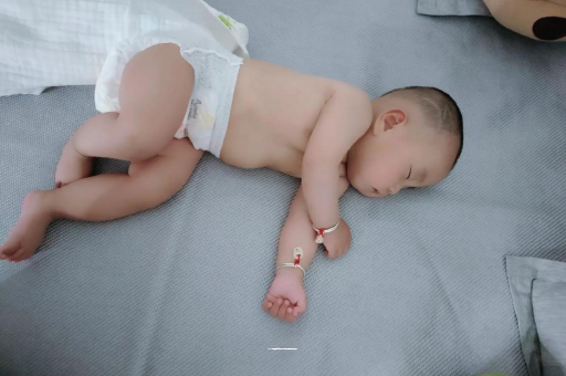 抚州六个月宝宝眼睛散光